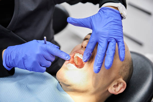Best Emergency Dental Extractions in Tri Lakes, IN